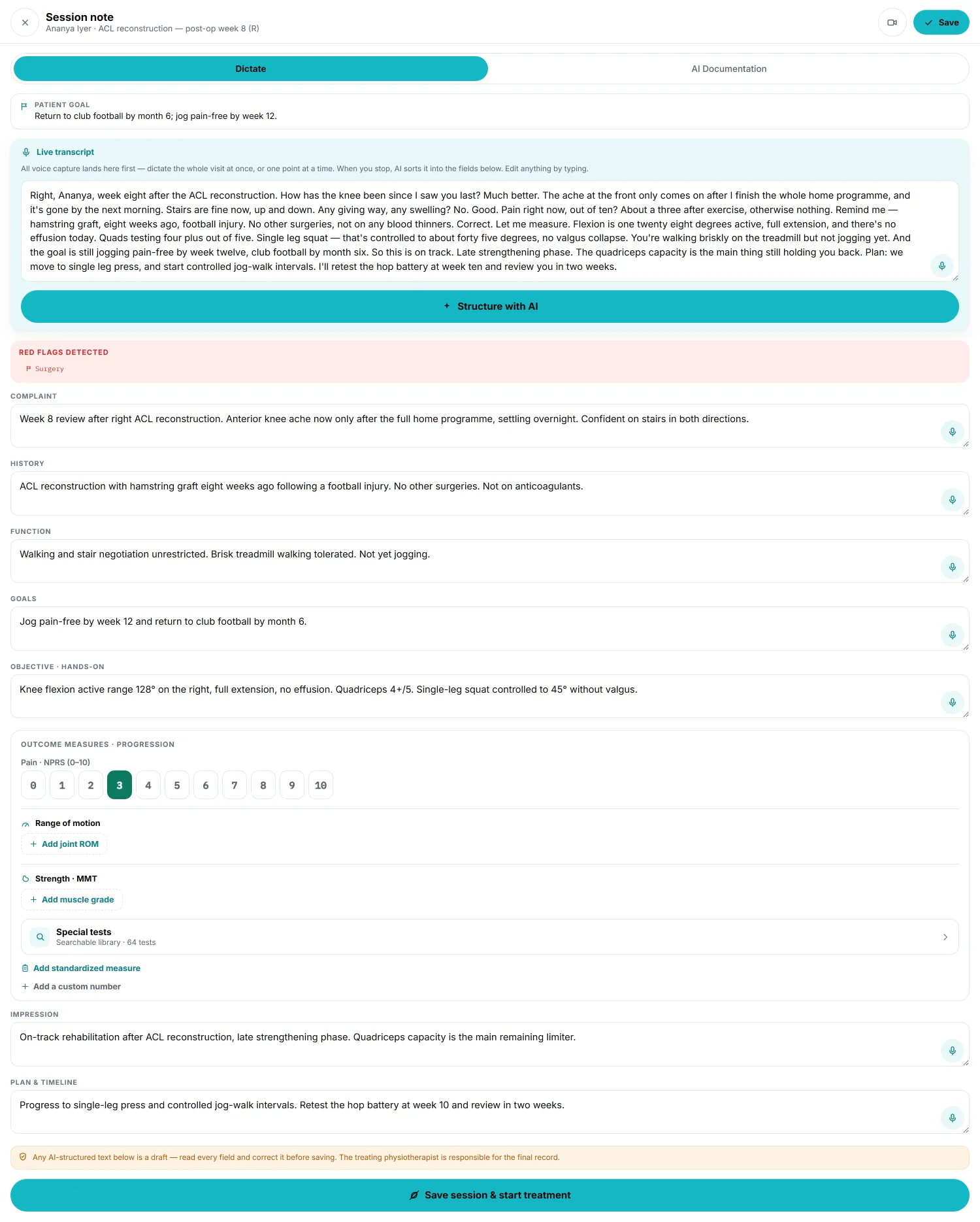 MotionDoc's Consultation screen after AI structuring. The spoken consultation sits in the live transcript at the top; below it the scribe has filled complaint, history, function, goals, objective, impression and plan, set the pain score to 3, and surfaced the recent surgery as a red flag. Every field is an editable text box, above a notice that the draft must be read and corrected before saving.